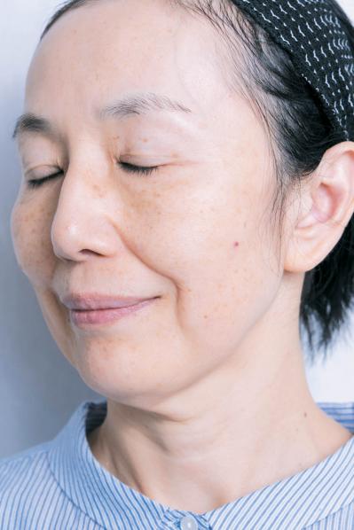 56歳読者モデルが体験！シミ・くすみに効く光治療（IPL）当日の流れと痛み、2日目の変化まで（サムネイル画像4）